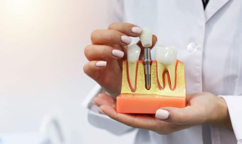 Are You a Candidate for Dental Implants? Factors to Consider