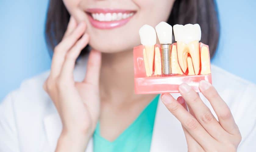 Top 5 Frequently Asked Questions About Dental Implants in Sandy