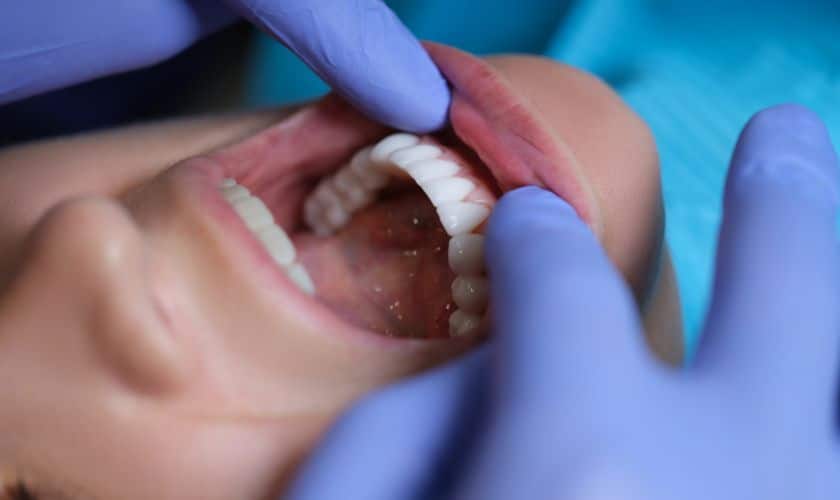 Early Detection Saves Lives: The Importance of Oral Cancer Screenings