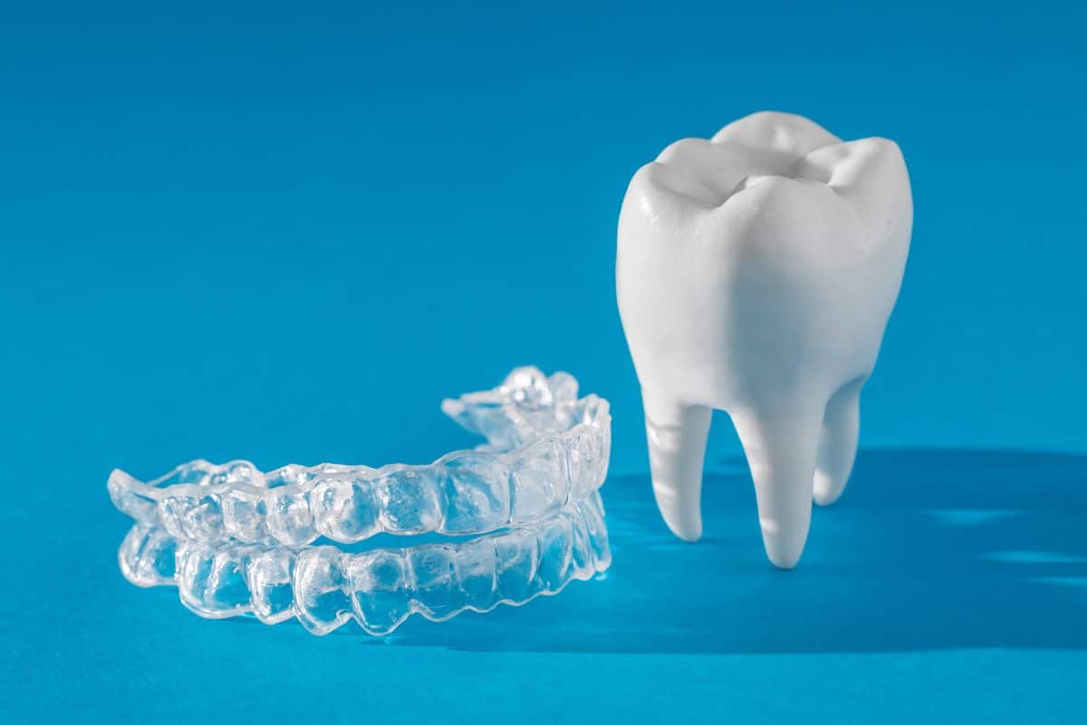 Can Invisalign Fix Overbite & How Long Does it Take?
